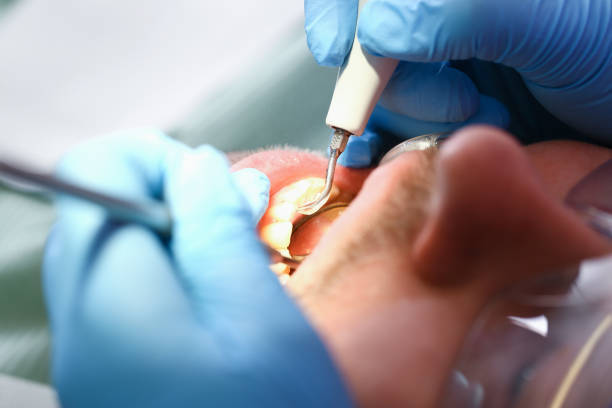 Best Dentist for Severe Toothache  in Bainbridge Island, WA